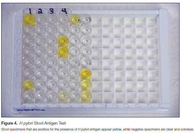 Figure 4. H pylori Stool Antigen Test